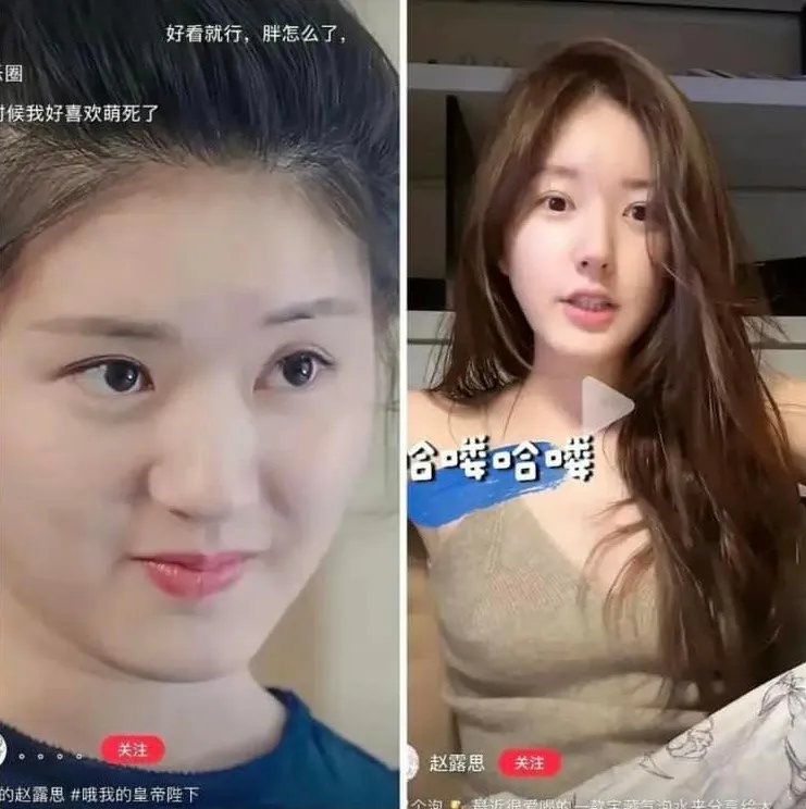 yeah1-trieu-lo-tu-vuong-nghi-van-sua-mui (5)