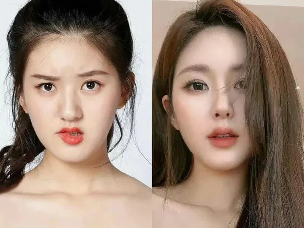 yeah1-trieu-lo-tu-vuong-nghi-van-sua-mui (7)