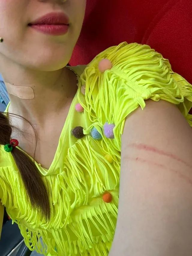 yeah1-thuy-ngan-bi-thuong-lan-ngoc-xin-loi (4)