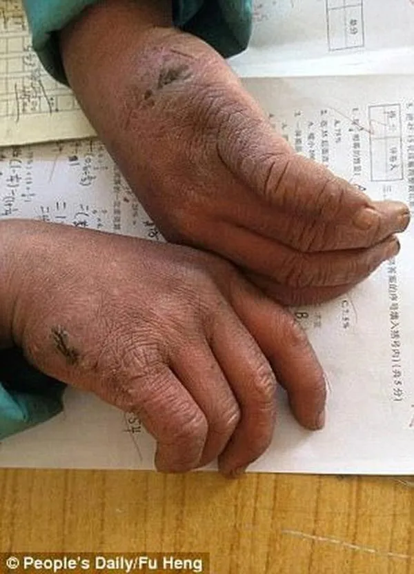 cuoc-song-hien-tai-cua-cau-be-bang-tuyet (5)