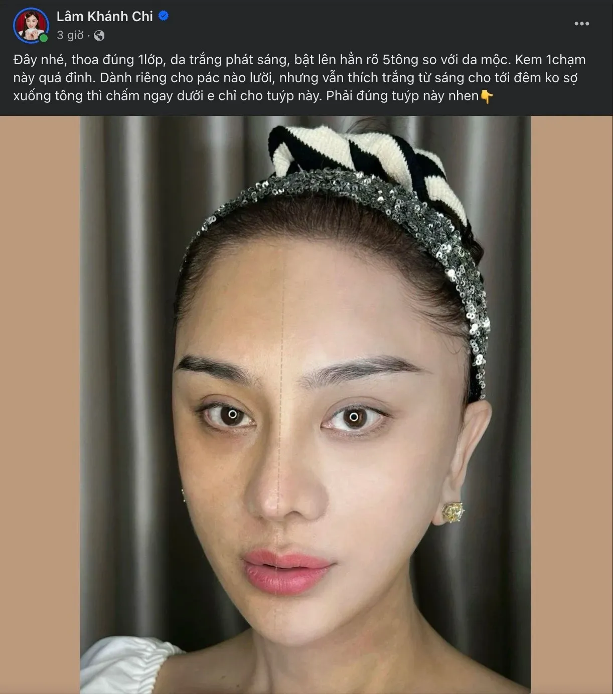 lam-khanh-chi-vuong-tranh-cai-vi-quang-cao-kem-lo (5)