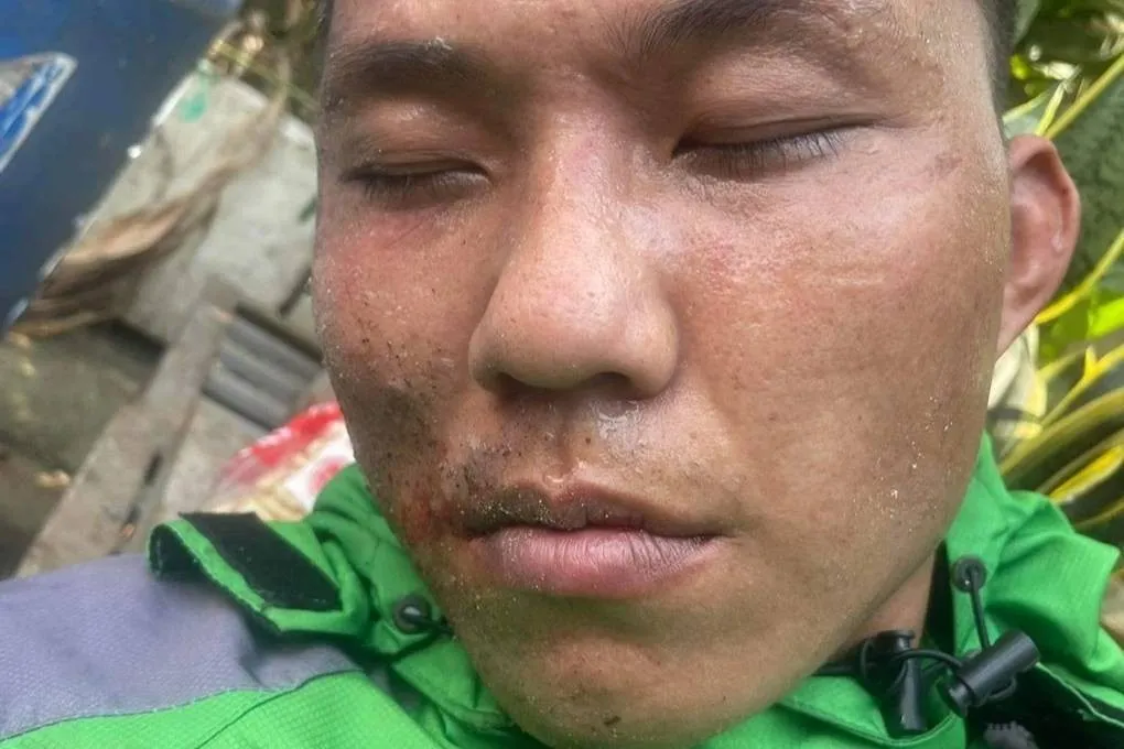 nguoi-dan-ong-giat-day-chuyen-xau-nhan-vang-24k-cua-co-dau (1)