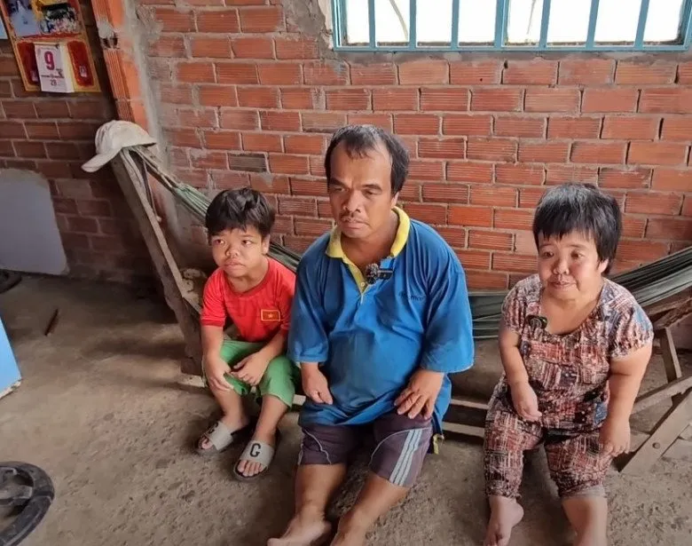 gia-dinh-3-nguoi-ti-hon-o-ben-tre-chi-cao-1m (1)