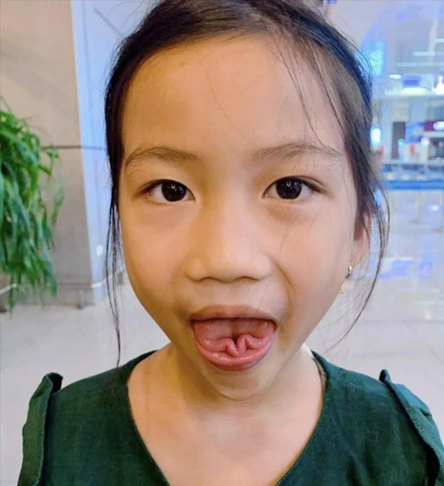 con-gai-oc-thanh-van-so-huu-tai-le-chi-1-dan-so-the-gioi-lam-duoc (4)