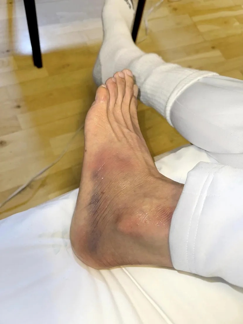 dan-truong-tiet-lo-tinh-trang-suc-khoe-sau-su-co-nga-cau-thang (3)