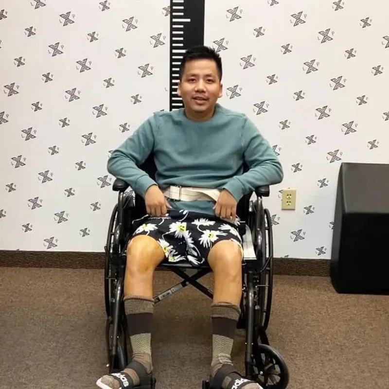 khoa-pug-tu-tin-sau-khi-keo-chan-2