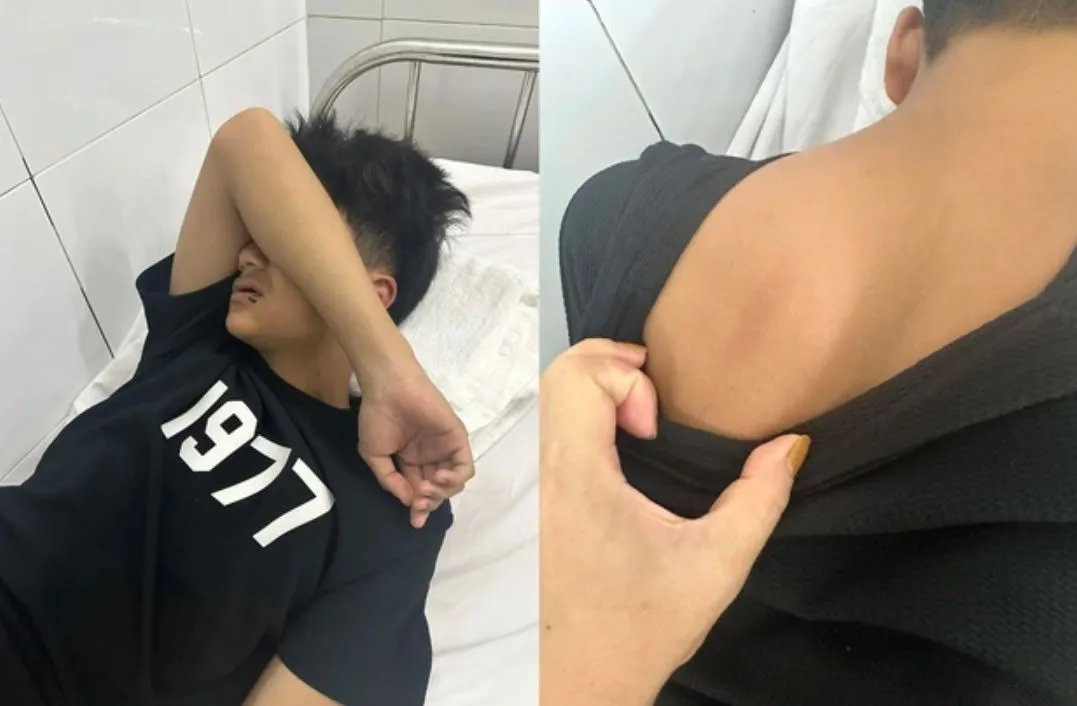 nam-sinh-lop-9-bi-nhom-nguoi-la-mat-tan-cong-khi-di-tam-bien-1