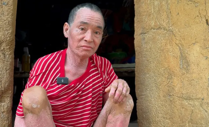 nguoi-dan-ong-moc-vay-toan-than-ca-ngay-ru-ru-trong-nha-vi-so-anh-nang-mat-troi-3