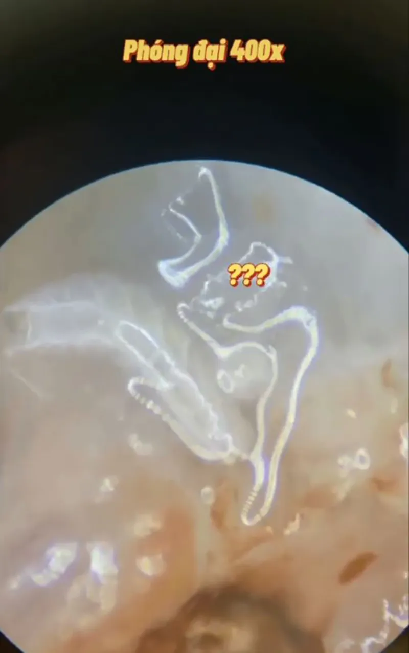 soi-qua-vai-duoi-kinh-hien-vi-thay-vat-la-cu-dong-khong-ai-biet-bi-mat-nay-5