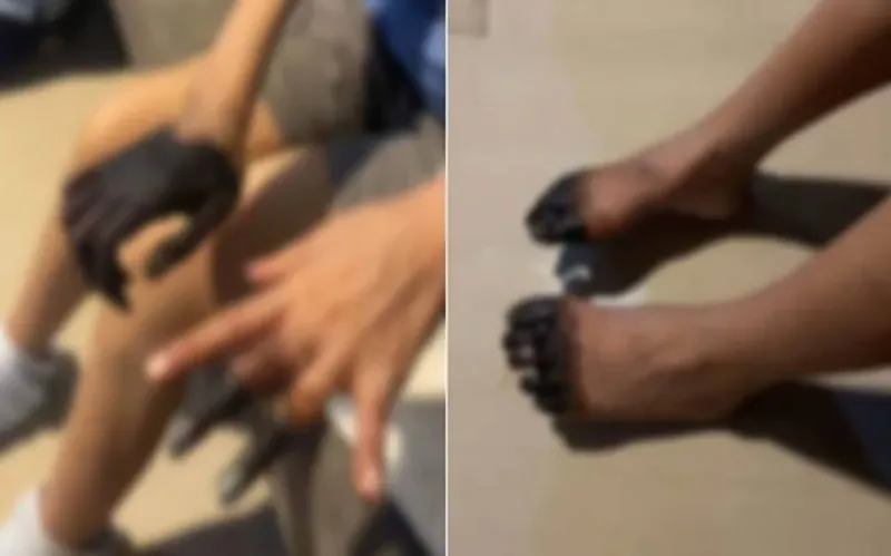 nguoi-phu-nu-di-chua-tao-thao-ruot-ai-ngo-bi-mat-gan-het-ngon-tay-ngon-chan-1