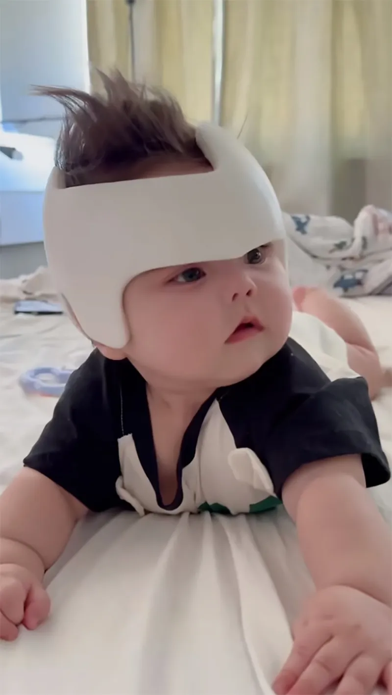 con-gai-5-thang-tuoi-mac-chung-dau-khong-tron-cap-doi-dong-gioi-viet-nam-dua-con-sang-my-dieu-tri-1