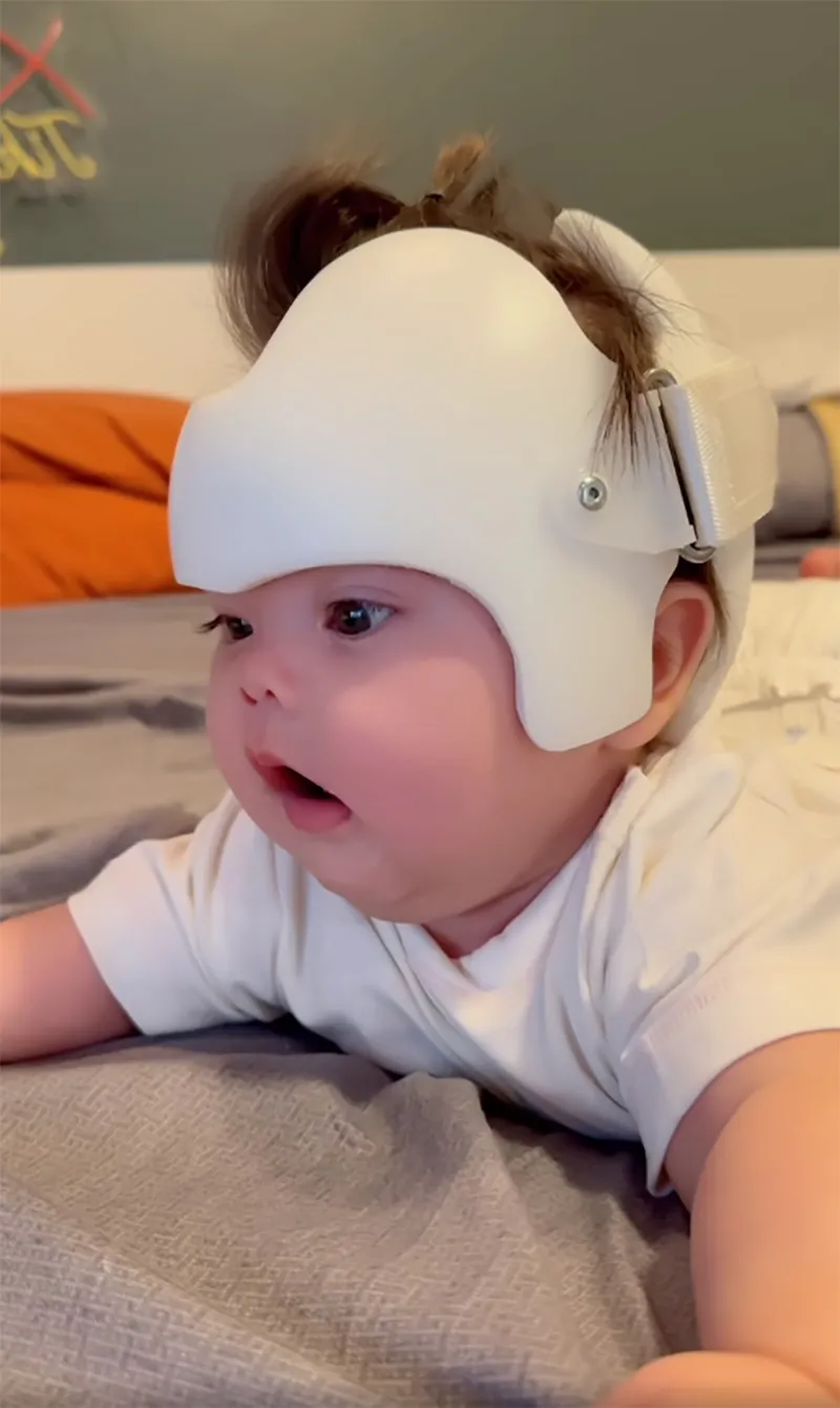 con-gai-5-thang-tuoi-mac-chung-dau-khong-tron-cap-doi-dong-gioi-viet-nam-dua-con-sang-my-dieu-tri-3