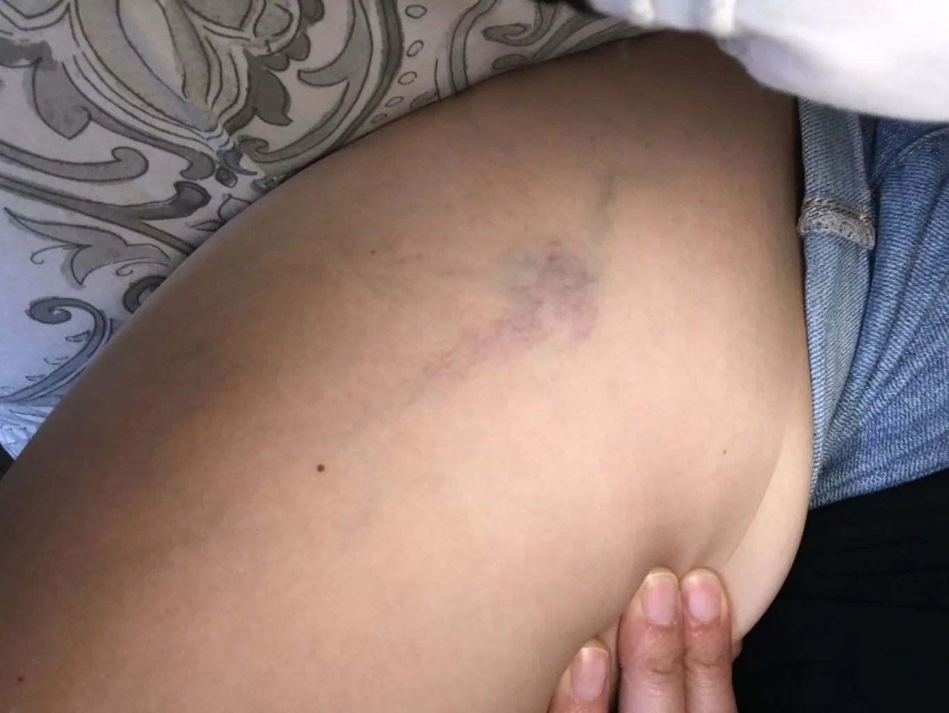 vi-sao-con-gai-thuong-bi-bam-tim-dau-goi-2