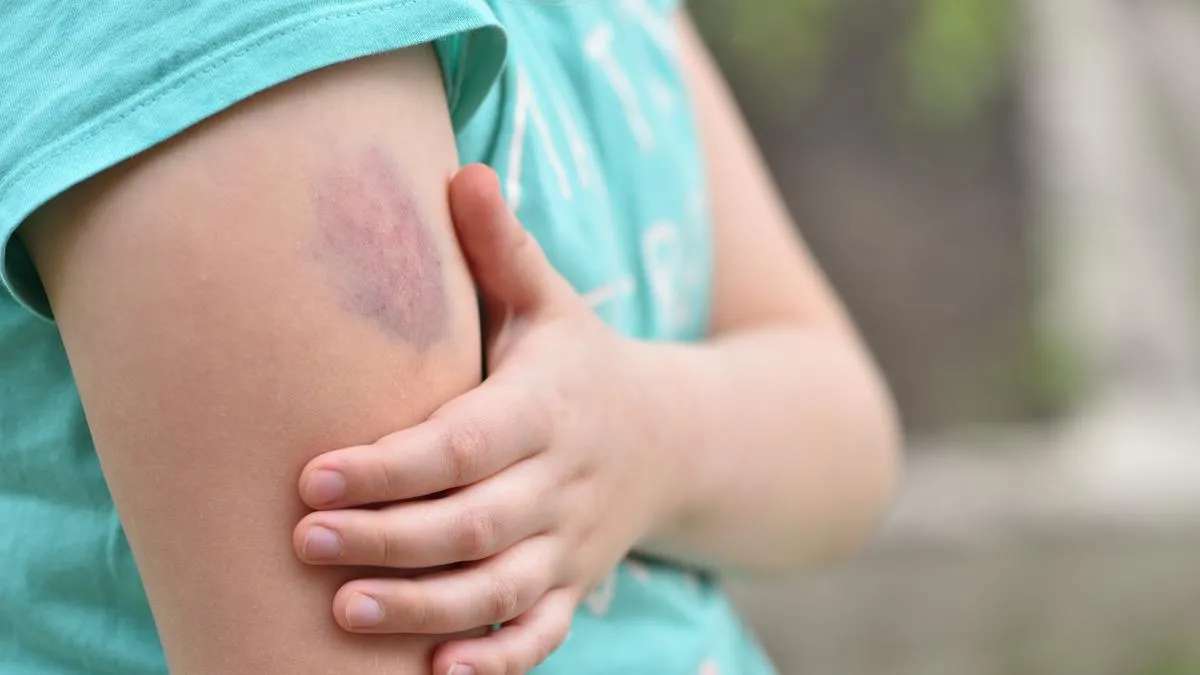 vi-sao-con-gai-thuong-bi-bam-tim-dau-goi-4