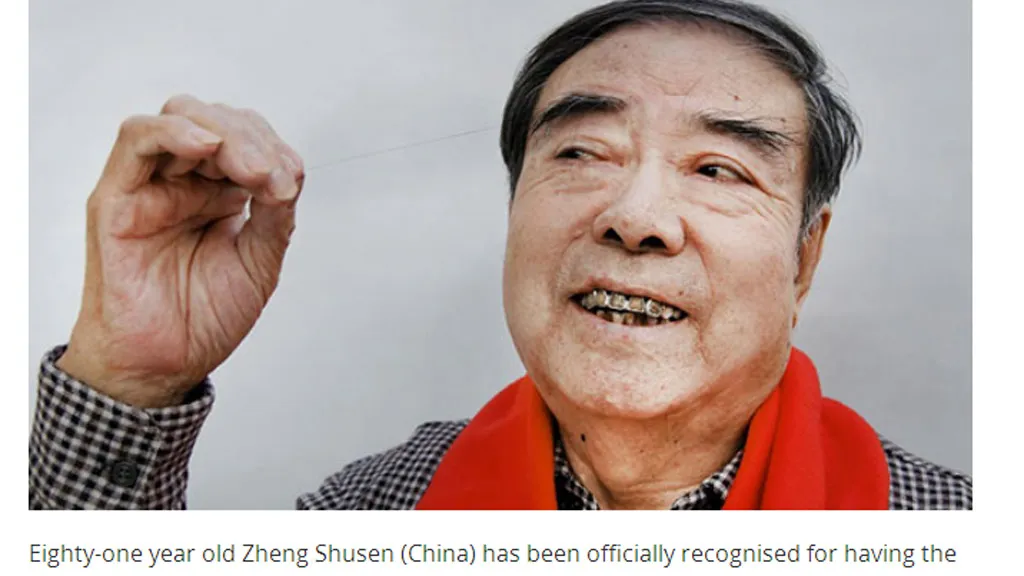 long-may-moc-dai-o-tuoi-60-tuong-la-dau-hieu-truong-tho-nhung-su-that-khong-phai-3