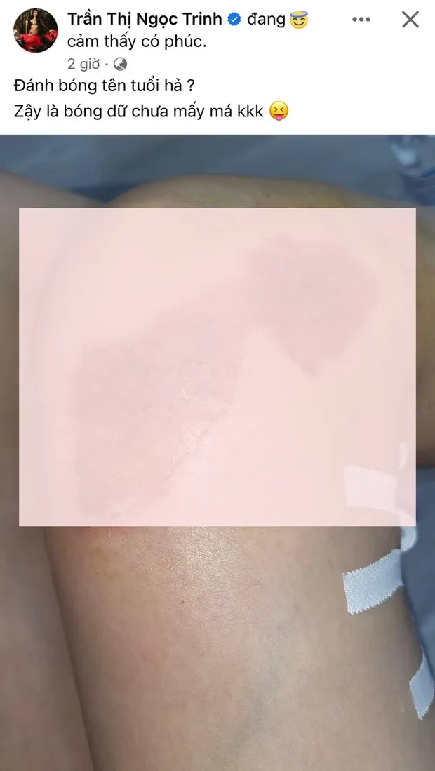 sau-clip-lai-xe-moto-bi-xu-phat-ngoc-trinh-tiep-tuc-nhan-gach-da-vi-1-hanh-dong-bi-cho-la-thach-thuc-3