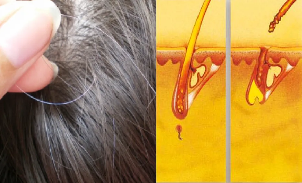 nguoi-viet-thich-nho-toc-bac-nhung-day-la-thoi-quen-cuc-ky-nguy-hiem-chuyen-gia-khuyen-bo-ngay-2