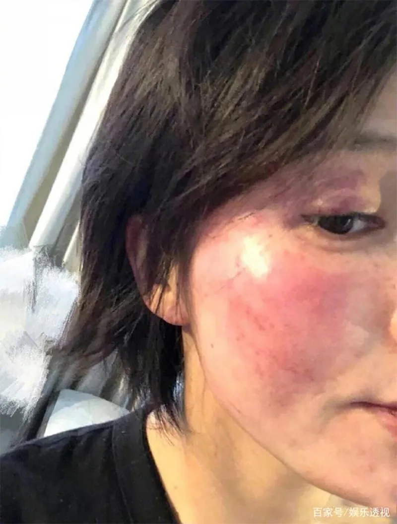 vo-cu-mot-sao-nam-hang-a-he-lo-hop-dong-bit-mieng-700-ty-giu-bang-chung-khien-chong-cu-mat-su-nghiep-5