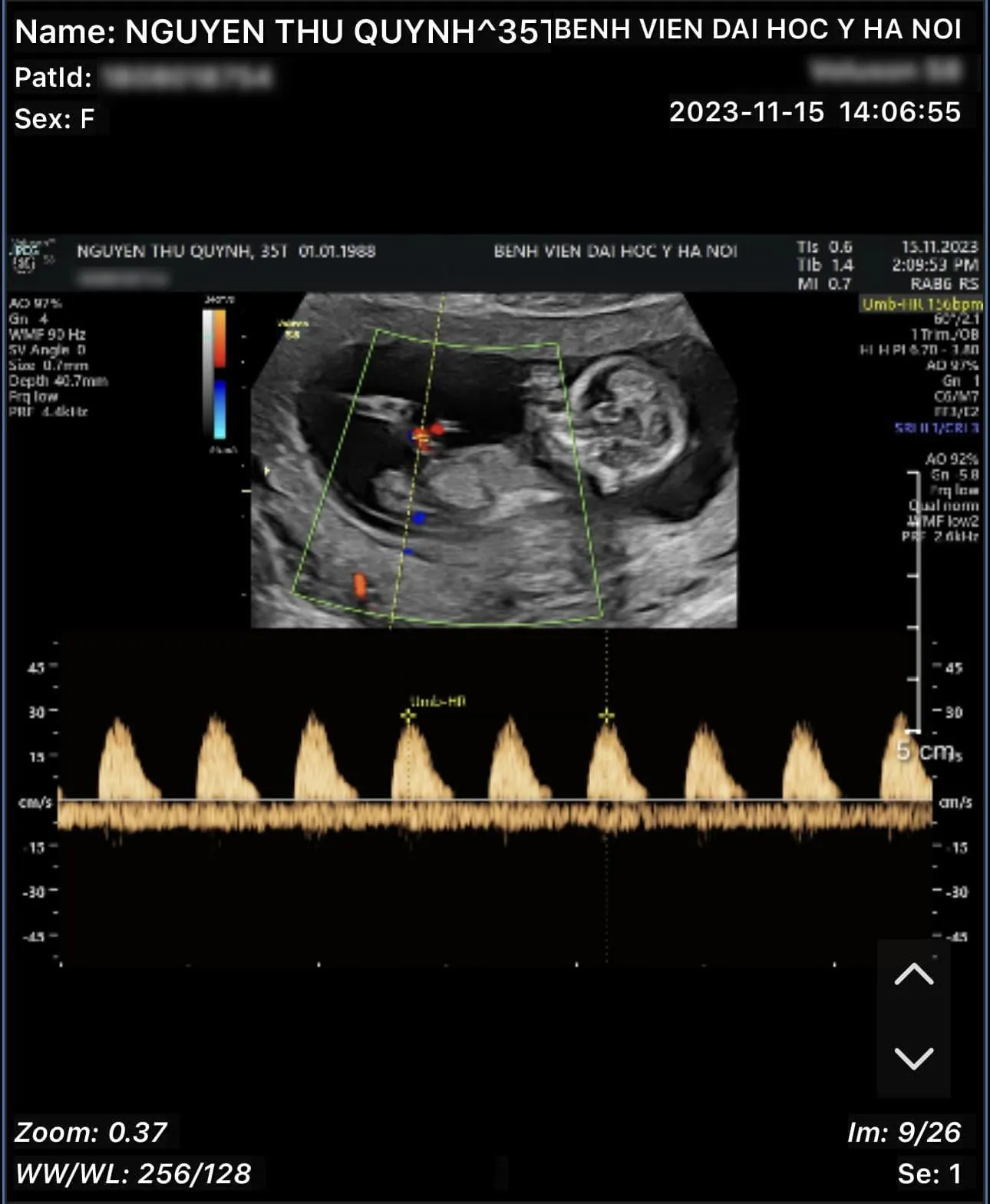 danh-tinh-ban-trai-my-soi-thu-quynh-duoc-netizen-truy-lung-rot-cuoc-la-ai-2