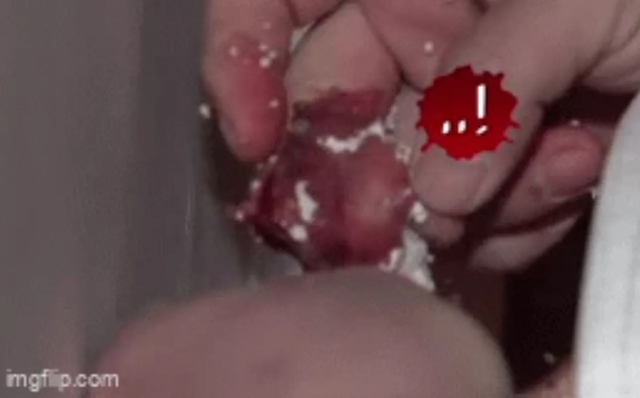 thay-chat-long-mau-do-chay-ra-tu-trong-vach-tuong-chu-nha-tuc-toc-goi-nguoi-kiem-tra-phat-hien-su-that-7