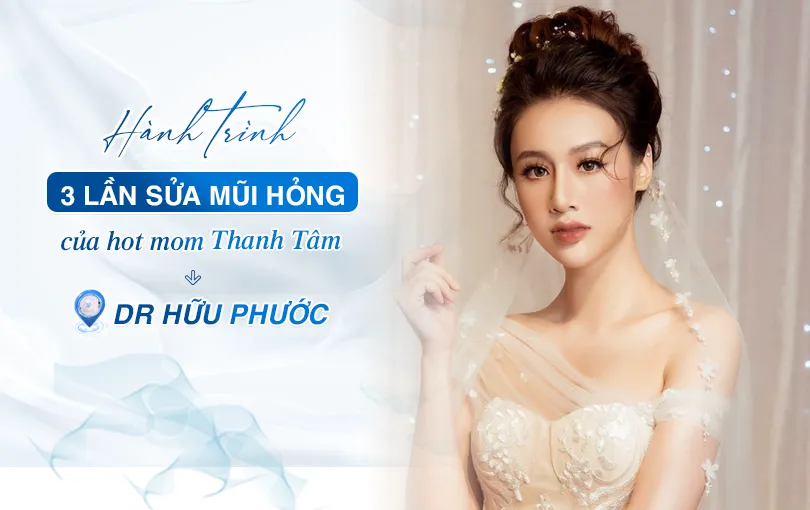 Ảnh Thumb báo file ảnh resize kích thước