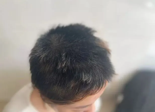 thieu-nu-16-tuoi-bi-chu-tiem-spa-tac-dong-vat-ly