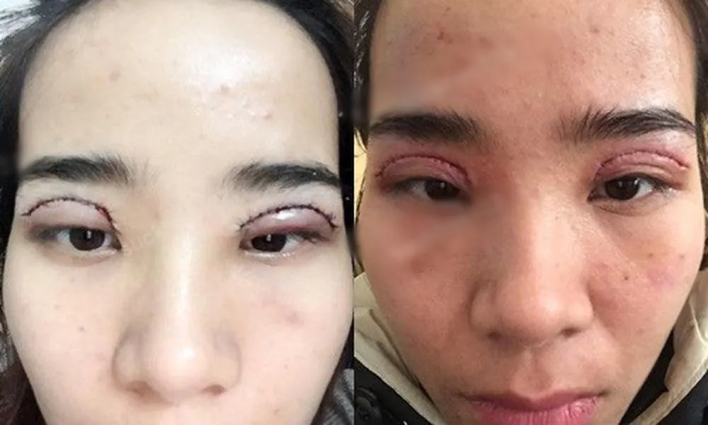 co-gai-hong-mat-vi-de-hoc-vien-thu-viec-cat-mi-2