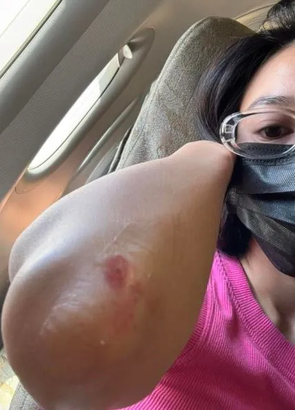 ninh-duong-lan-ngoc-su-co-dam-cuoi-puka