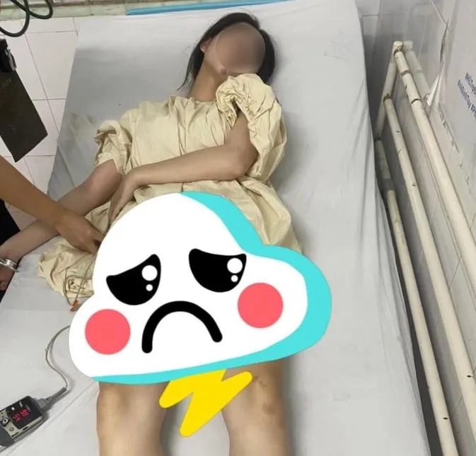 co-gai-17-tuoi-mu-mat-do-nang-mui-1