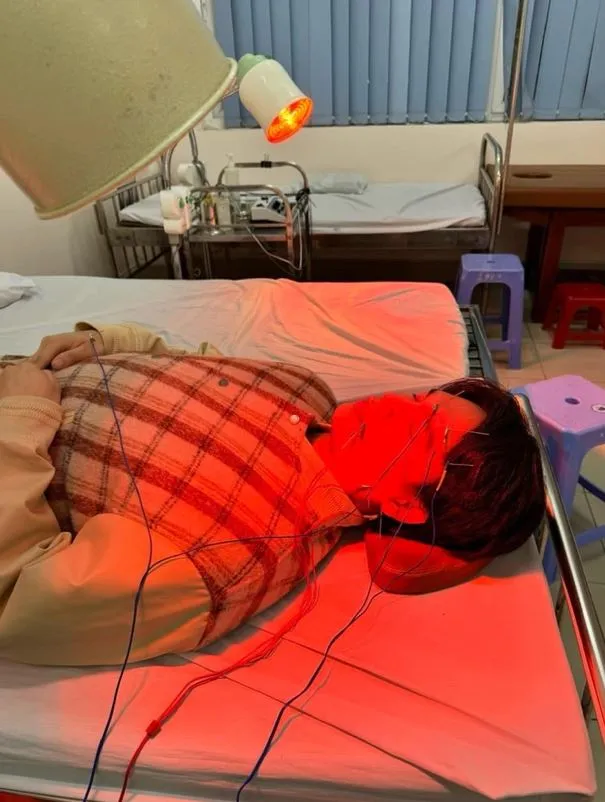 nguyen-tran-trung-quan-liet-nua-mat-1