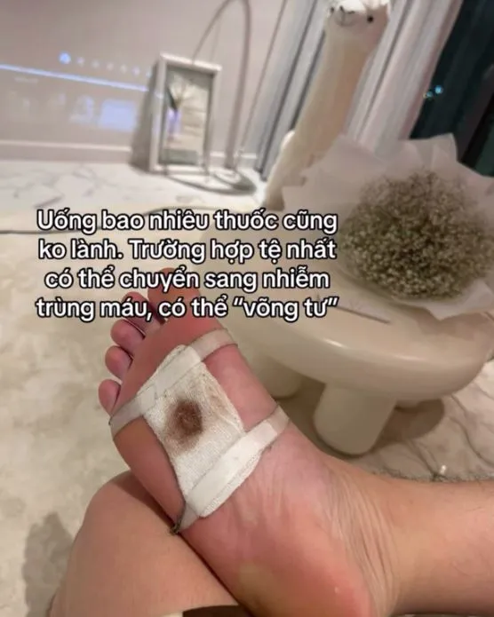 phat-la-bi-thuong-khi-ghi-hinh-1