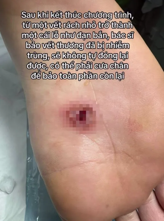 phat-la-bi-thuong-khi-ghi-hinh