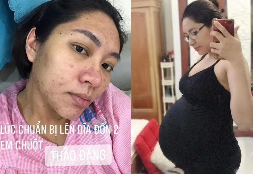 hoa-hau-bi-chong-tuong-tac-2