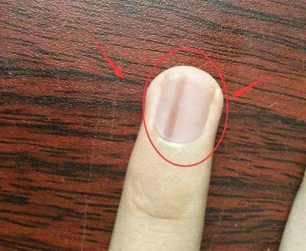 z5518561833822_8394e8e1046a37aae80b06974f4e6baf