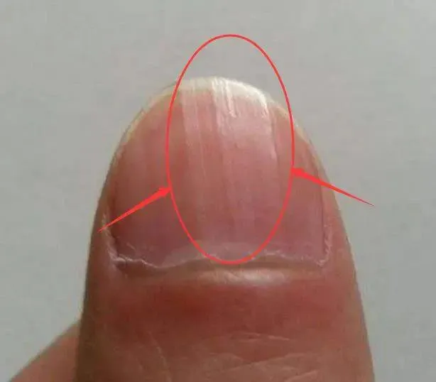 z5518561833823_d4546b619fdddd38ea145398c4376905