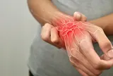 Hợp chất tự nhiên mở hướng tiếp cận mới trong điều trị viêm khớp dạng thấp