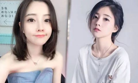 Nữ streamer Phùng Đề Mạc bị nghi phẫu thuật thẩm mỹ