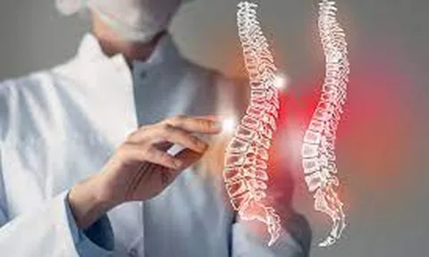 Võng lưng là gì? Các bài tập cải thiện võng lưng tại nhà