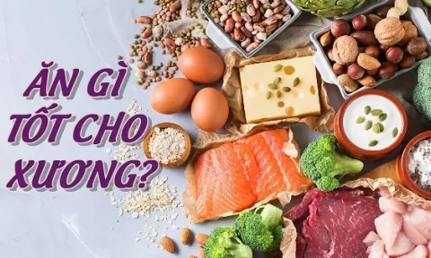 Top 8 thực phẩm tốt cho xương khớp giảm đau nhức hiệu quả