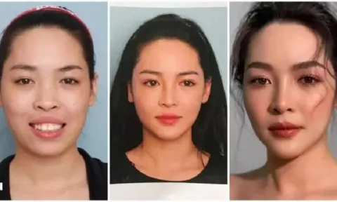Vũ Thanh Quỳnh đổi đời sau 8 năm 'đập mặt xây lại', 30 tuổi có mọi thứ trong tay