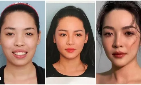 'Hot girl thẩm mỹ' Vũ Thanh Quỳnh bị đào lại ảnh 'nguyên thủy' 8 năm trước
