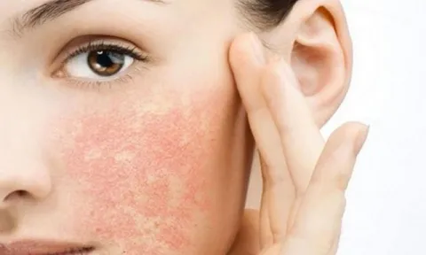 BHA bao nhiêu tuổi dùng được & Cách dùng BHA đúng cách như thế nào?