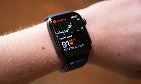 Apple Watch có thể cảnh báo người dùng về triệu chứng của nhồi máu cơ tim