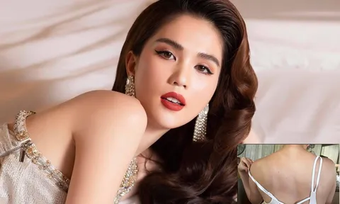 Ngọc Trinh bị cháy da đỏ rát, lý do đằng sau khiến nhiều người xót xa