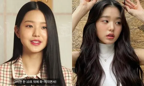Rộ nghi vấn nữ idol Jang Won Young tiêm môi, nhiều người chỉ ra bằng chứng