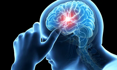 Tin vui cho người bị đau nửa đầu mạn tính: Đã có sản phẩm hỗ trợ giảm đau thảo dược Bách Thống Vương