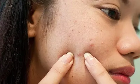 6 sai lầm phổ biến khi chăm sóc da mà bạn cần phải tránh nếu không muốn da xuống cấp