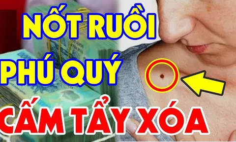 7 nốt ruồi quý hơn vàng, ai có 1 cái đã quá may, cả đời ăn không hết của