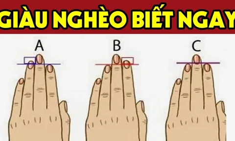 Nhìn bàn tay có đặc điểm này, ắt là số phú quý giàu sang