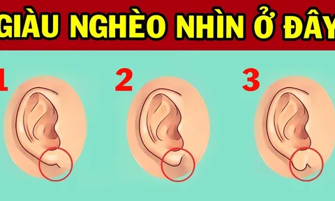 Nhìn tướng tai 3 giây biết tương lai bạn thành Phượng Hoàng hay nghèo mạt kiếp